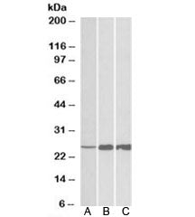 Western blot testing of human [A], mouse [B] and rat [C] skeletal muscle lysate with TNNI2 antibody 