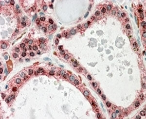 IHC staining of FFPE human thyroid gland with KCNN2 antibody at 4ug/ml. HIER: steamed with pH6 citra