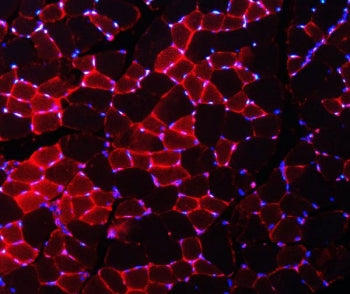Nedd4 Antibody