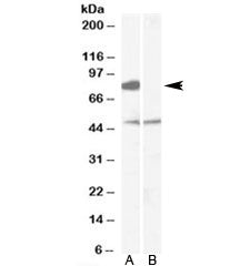 Western blot testing of human brain [frontal cortex] lysate with [B] and without [A] immunizing pept