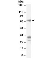 Western blot testing of rat testis lysate with Sall4 antibody at 0.1ug/ml. Predicted molecular weigh