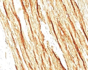 IHC staining of FFPE human colon tissue with recombinant Smoothelin antibody (clone SMTN/2320R). HIE