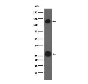 Western blot testing of human A549 cell lysate with Integrin alpha V antibody. Expected molecular we