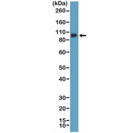 Western blot testing of mouse spleen tissue lysate with recombinant CD61 antibody at 1:5000 dilution