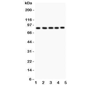 Western blot testing of FOXM1 antibody and Lane 1: HeLa; 2: COLO320; 3: SW620; 4: SKOV; 5: MCD-7. Pr