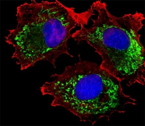 ALDH6A1 Antibody, 0.4ml