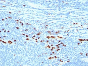 MRP14 Antibody / S100A8/9 Complex / Calprotectin