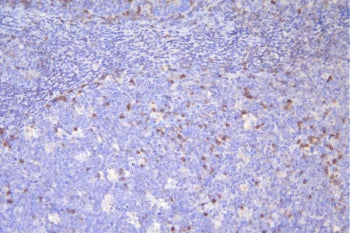 CD79a Antibody