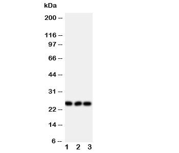 Western blot testing of FGF19 antibody and Lane 1: rat brain; 2: human U87; 3: human SMMC-7721 cell 