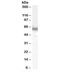Western blot testing of human placenta lysate with S6K antibody at 0.05ug/ml. Predicted molecular we