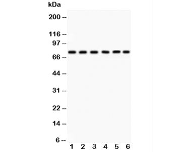 PKC delta Antibody