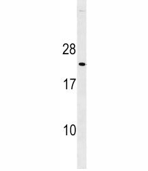 p27Kip1 Antibody