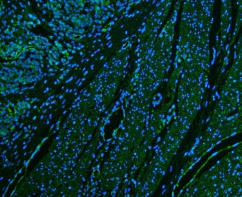 CD39 Antibody