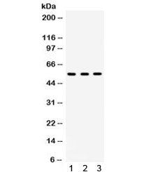 Integrin linked kinase Antibody (ILK)