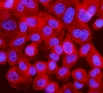 Immunofluorescent staining of FFPE human A431 cells with Interferon regulatory factor 3 antibody (re