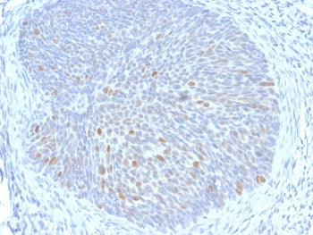 HPV-16 E1/E4 Antibody
