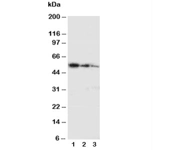 Western blot testing with Ki-67 antibody and partial human recombinant protein; Lane 1: 10ng; 2: 5ng
