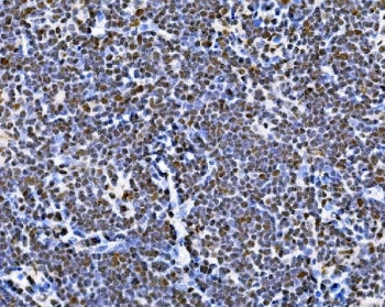BUB1 Antibody
