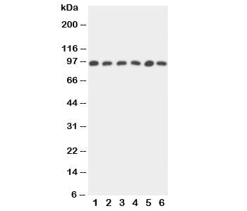 Western blot testing of STAT5b antibody and Lane 1: rat intestine; 2: rat kidney; and human samples 