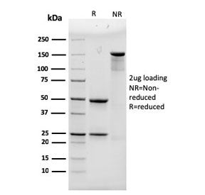 ACTN4 Antibody / Alpha Actinin 4
