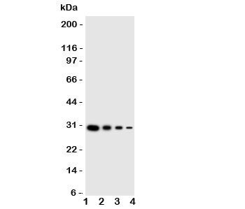 Western blot testing of LTK antibody and human recombinant protein; Lane 1: 10ng; 2: 5ng; 3: 2.5ng; 