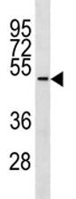 Tubulin delta 1 Antibody (TUBD1)