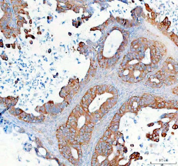 Immunohistochemical staining of SYNJ2 using anti-SYNJ2 antibody. SYNJ2 was detected in a paraffin-em
