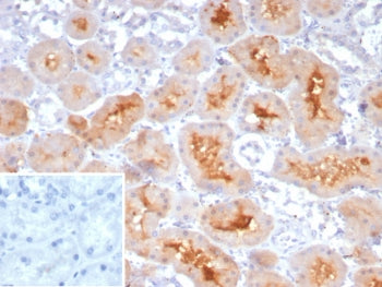 IHC staining of FFPE human kidney tissue with NRP1 / Neuropilin-1 antibody (clone NRP1/4620). Inset: