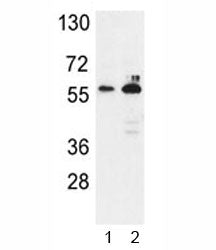Western blot analysis of G6PD antibody and 1) K562, 2) MCF-7 lysate. Predicted molecular weight ~59 
