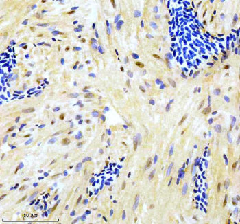 IHC staining of zebrafish Gata6 protein using Zebrafish Gata6 antibody, HRP-labeled secondary and DA
