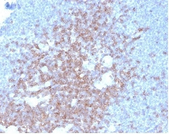IHC staining of FFPE human lymph node tissue with CD2 antibody (clone LFA2/7102) at 2ug/ml in PBS fo