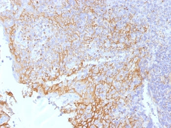 IHC testing of FFPE human tonsil tissue with Beta Catenin antibody (clone 5H10). Required HIER: boil