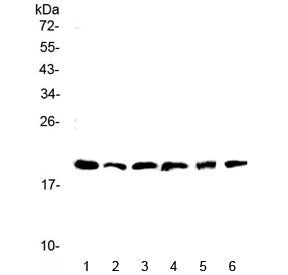 Western blot testing of mouse 1) brain, 2) spleen, 3) heart, 4) liver, 5) kidney and 6) testis lysat