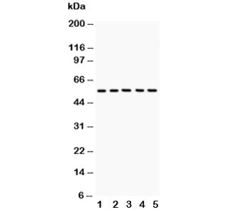Western blot testing of GLUT4 antibody and Lane 1: rat heart; 2: rat skeletal muscle; 3: mouse heart
