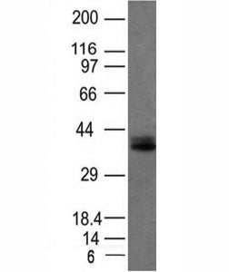 EpCAM Antibody