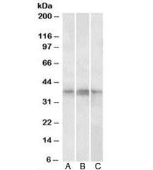 Western blot testing of A) Daudi, B) Jurkat whole and C) Jurkat nuclear lysates with PHF11 antibody 