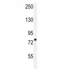 CPT1C antibody western blot analysis in HL-60 lysate. Predicted molecular weight 81-91 kDa.