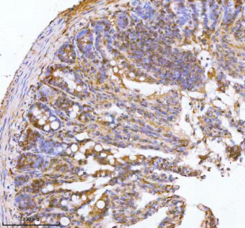 Immunohistochemical staining of PAFAH1B2 using anti-PAFAH1B2 antibody. PAFAH1B2 was detected in a pa
