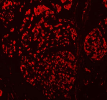 TBX18 Antibody / T-box protein 18