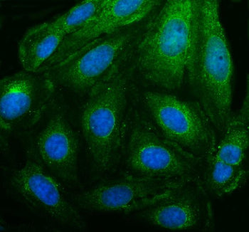 PEX14 Antibody / Peroxisomal biogenesis factor 14, 100ug