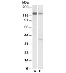 Western blot testing of human Daudi [A] and mouse spleen [B] lysates with ARS2 antibody at 0.1ug/ml.