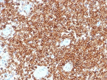 IHC staining of FFPE human tonsil tissue with CD45RA antibody (clone PTPRC/4367R). HIER: boil tissue