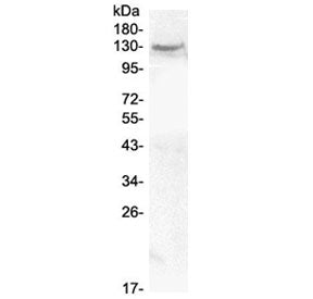 Western blot testing of human MCF7 cell lysate with CACNA2D2 antibody at 0.5ug/ml. Predicted molecul