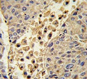 IHC testing of FFPE human tonsil tissue with Collectin 11 antibody. HIER: steam section in pH6 citra