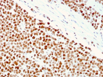 IHC staining of FFPE human small intestine with MSH6 antibody (clone MSH6/3086). HIER: boil tissue s