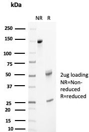 SDS-PAGE analysis of purified, BSA-free APO-J antibody (clone CLU/4733) as confirmation of integrity and purity.