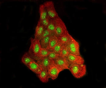 Immunofluorescent staining of FFPE human A431 cells with BRD2 antibody (green) and Tubulin beta mAb 