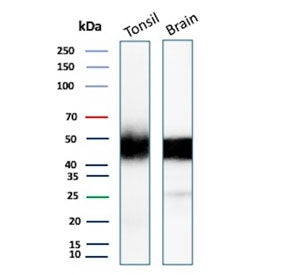 Western blot testing of human tonsil and brain tissue lysate with recombinant PDCD1 antibody. Predic