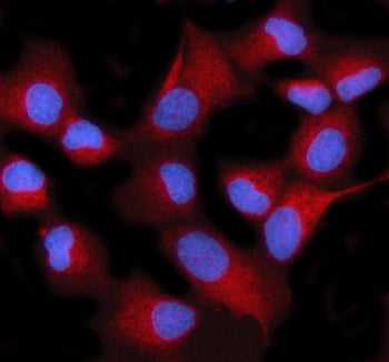 Immunofluorescent staining of STIM2 using anti-STIM2 antibody (red). STIM2 was detected in an immuno