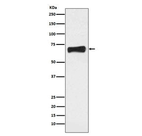 Western blot testing of human MCF7 cell lysate with LRH1 antibody. Predicted molecular weight ~61 kD